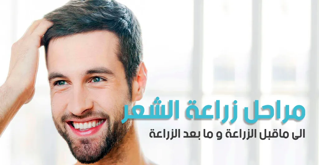 مراحل زراعة الشعر